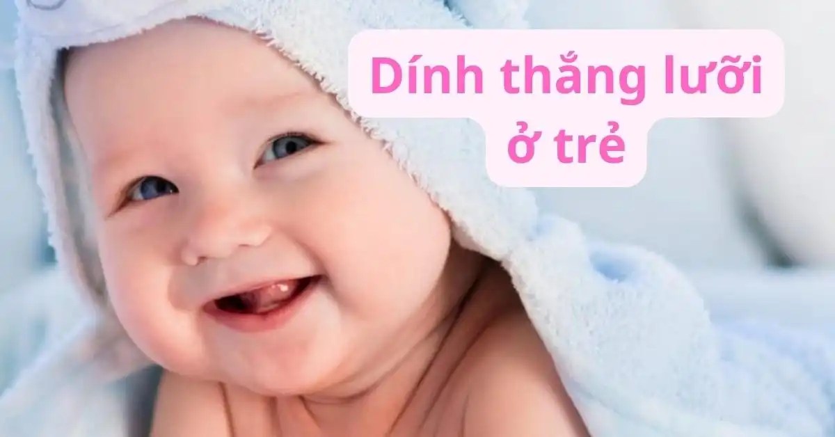 nguyen-nhan-trieu-chung-va-cach-dieu-tri-benh-dinh-thang-luoi-o-tre-em